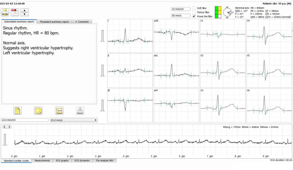 ECG testing - cardio check-up at home